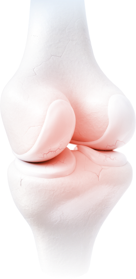 osteoarthritis