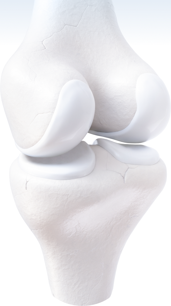 osteoarthritis